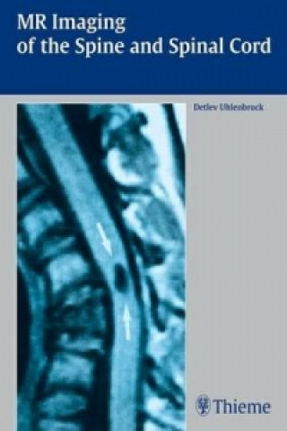 Książka MR Imaging of the Spine and Spinal Cord Detlev Uhlenbrock
