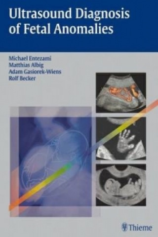 Kniha Ultrasound Diagnosis of Fetal Anomalies Matthias Albig