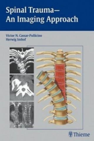 Carte Spinal Trauma - An Imaging Approach Victor N. Cassar-Pullicino