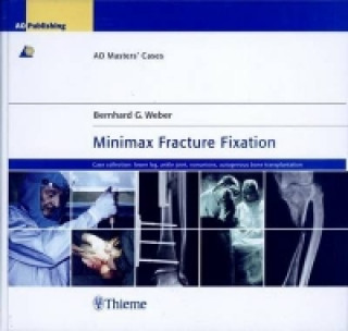 Kniha Minimax Fracture Fixation Bernhard G. Weber