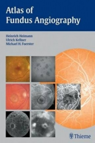 Книга Atlas of Fundus Angiography Michael H. Foerster