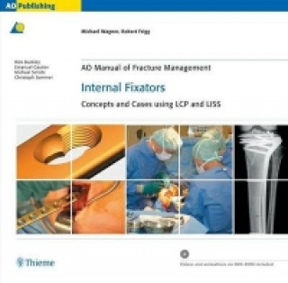 Carte AO Manual of Fracture Management - Internal Fixators Robert Frigg