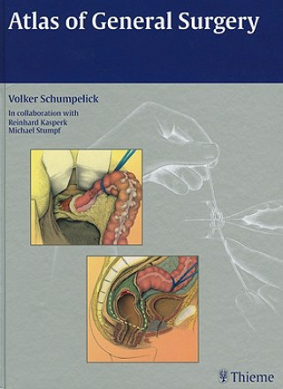Könyv Atlas of General Surgery Volker Schumpelick