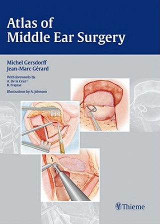 Carte Atlas of Middle Ear Surgery Michel Gersdorff