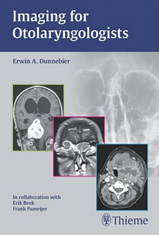 Livre Imaging for Otolaryngologists Erwin A. Dunnebier