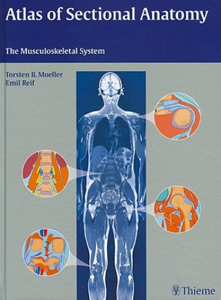 Kniha Atlas of Sectional Anatomy Torsten B. Moeller