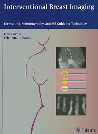 Kniha Interventional Breast Imaging Uwe Fischer