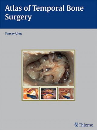 Libro Atlas of Temporal Bone Surgery Tuncay Ulug