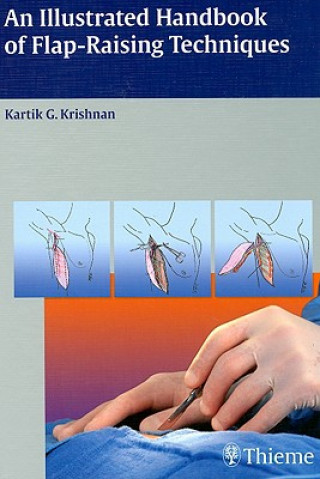 Książka Illustrated Handbook of Flap-Raising Techniques Kartik G. Krishnan