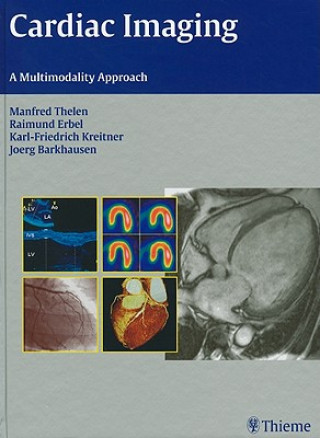 Könyv Cardiac Imaging Karl-Friedrich Kreitner