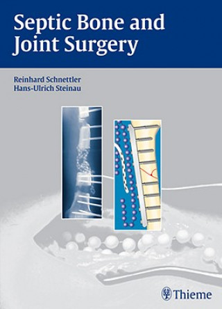 Carte Septic Bone and Joint Surgery Hans-Ulrich Steinau