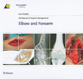 Kniha AO Manual of Fracture Management - Elbow & Forearm Jesse B. Jupiter