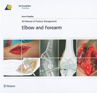 Book AO Manual of Fracture Management - Elbow & Forearm Jesse B. Jupiter