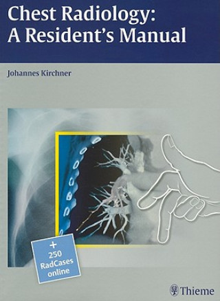 Книга Chest Radiology: A Resident's Manual Johannes Kirchner
