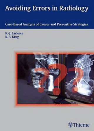 Βιβλίο Avoiding Errors in Radiology Klaus-Juergen Lackner