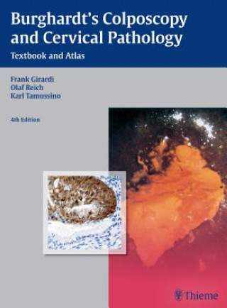 Kniha Burghardt's Colposcopy and Cervical Pathology Karl Tamussino