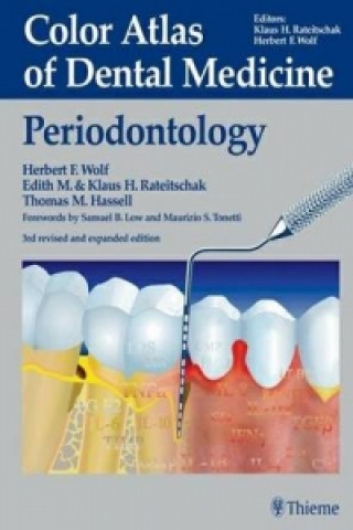 Книга Periodontology Klaus H. Rateitschak