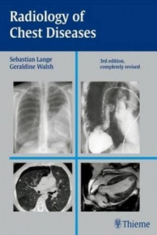 Könyv Radiology of Chest Diseases Geraldine Walsh