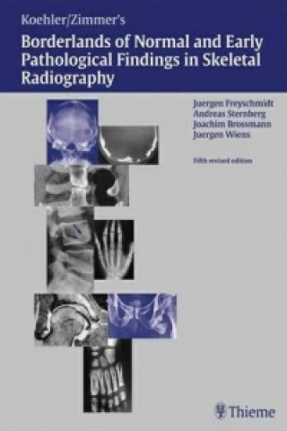 Libro Freyschmidt's "Koehler/Zimmer" Borderlands of Normal and Early Pathological Findings in Skeletal Radiography Jurgen Freyschmidt