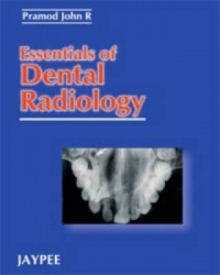 Book Essentials of Dental Radiology John R. Pramod