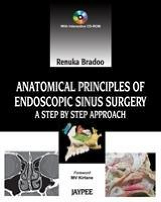 Kniha Anatomical Principles of Endoscopic Sinus Surgery Renuka Bradoo