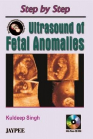 Könyv Step by Step Ultrasound of Fetal Anomalies Kuldeep Singh