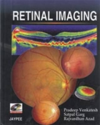 Carte Retinal Imaging Pradeep Venkatesh