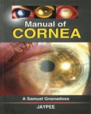 Carte Manual of Cornea A. Samuel Gnanadoss