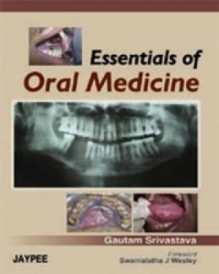 Kniha Essentials of Oral Medicine Gautam Srivastava