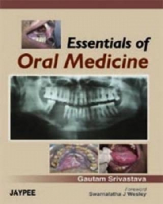 Livre Essentials of Oral Medicine Gautam Srivastava