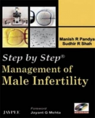 Książka Step by Step: Management of Male Infertility Manish R. Pandya