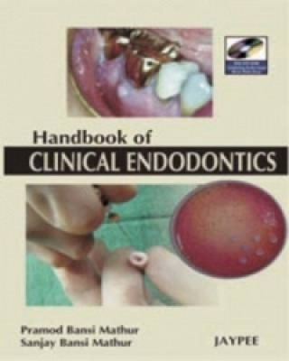 Könyv Hand Book of Clinical Endodontics Pramod Bansi Mathur