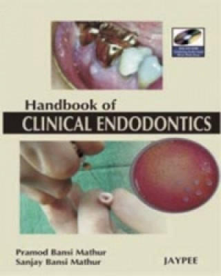 Libro Hand Book of Clinical Endodontics Pramod Bansi Mathur