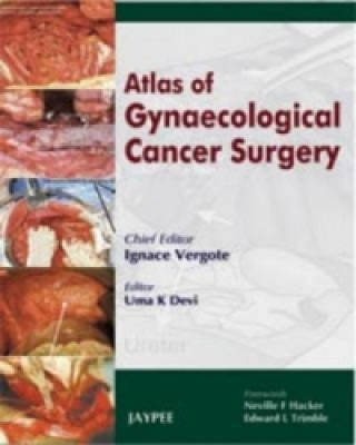 Kniha Atlas of Gynaecological Cancer Surgery Ignace Vergote