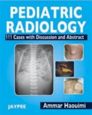 Kniha Pediatric Radiology Amar Haouimi