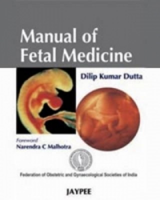 Kniha Manual of Fetal Medicine D. K. Dutta