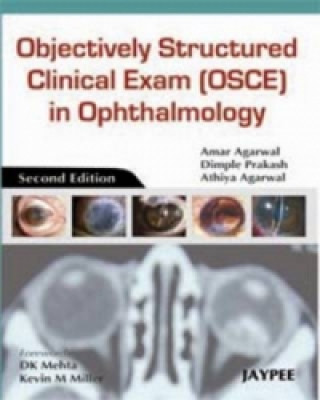 Könyv Objectively Structured Clinical Exam (OSCE) in Ophthalmology Amar Agarwal
