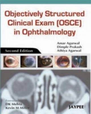 Buch Objectively Structured Clinical Exam (OSCE) in Ophthalmology Amar Agarwal