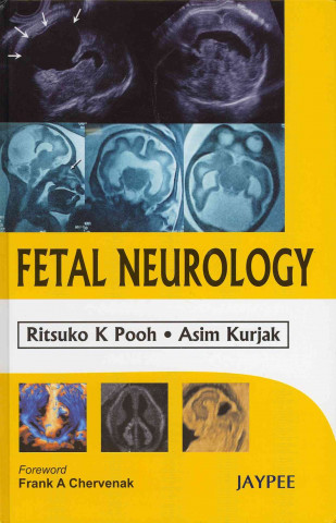 Książka Fetal Neurology Ritsuko K. Pooh