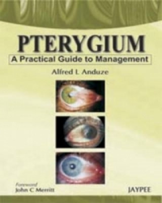 Книга Pterygium - A Practical Guide to Management Alfred L. Anduze