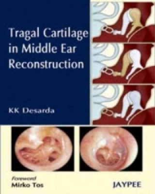 Kniha Tragal Cartilage in Middle Ear Reconstruction K. K. Desarda