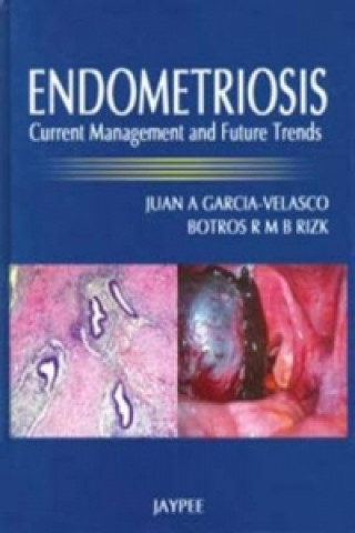 Książka Endometriosis Juan A. Garcia-Velasco