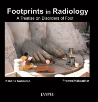 Carte Footprints in Radiology: A Treatise on Disorders of Foot Pramod Kolwadkar