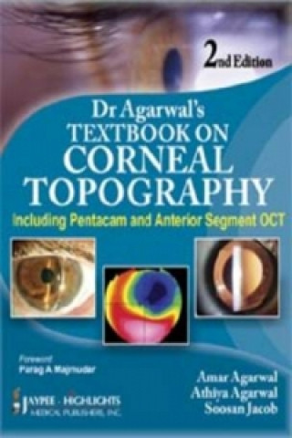 Buch Dr Agarwal's Textbook on Corneal Topography Amar Agarwal