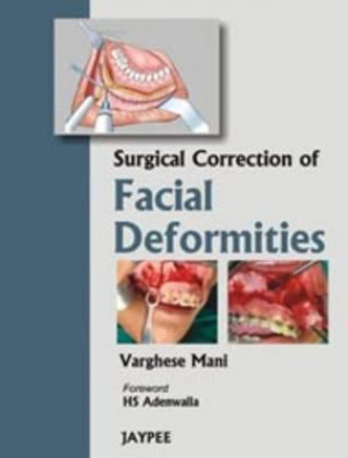 Książka Surgical Correction of Facial Deformities Varghese Mani