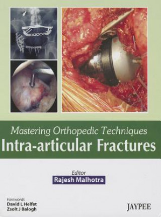 Carte Mastering Orthopedic Techniques: Intra-Articular Fractures Rajesh Malhotra
