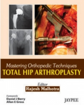 Knjiga Mastering Orthopedic Techniques: Total Hip Arthroplasty Rajesh Malhotra