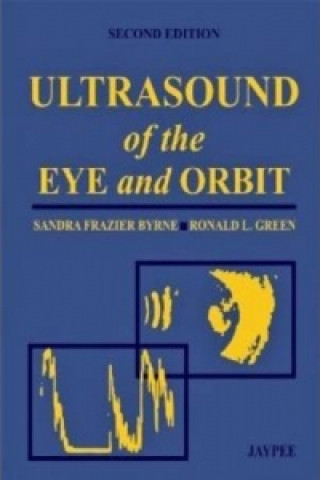 Kniha Ultrasound of the Eye and Orbit Sandra Frazier Byrne