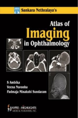 Kniha Atlas of Imaging in Ophthalmology S. Ambika