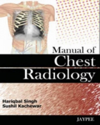 Buch Manual of Chest Radiology Hariqbal Singh